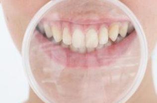 《磨牙》视频成人,成人磨牙现象的成因与应对策略  第3张