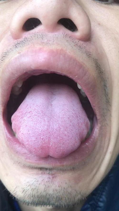 成人洗舌苔视频播放网站  第1张